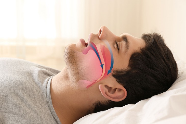 Những thực phẩm nên ăn và nên tránh với người bị bóng đè- Ảnh 3. Những thực phẩm nên ăn và nên tránh với người bị bóng đè- Ảnh 3.