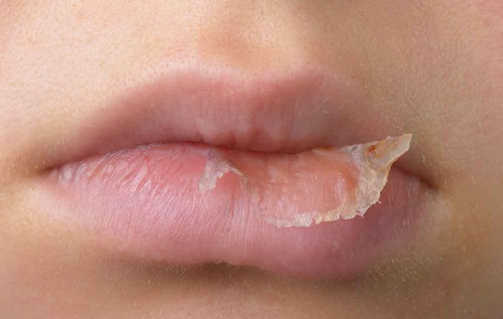 Mẹo tô son cho môi khô nẻ- Ảnh 1. Mẹo tô son cho môi khô nẻ- Ảnh 1.