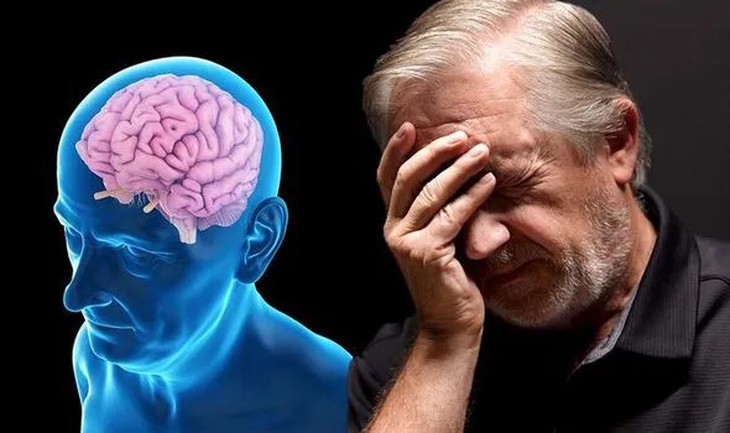 Thuốc điều trị bệnh Alzheimer giai đoạn đầu- Ảnh 1. Thuốc điều trị bệnh Alzheimer giai đoạn đầu- Ảnh 1.