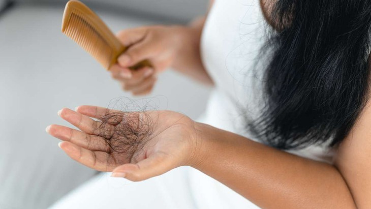 Vì sao tóc rụng nhiều?- Ảnh 1. Vì sao tóc rụng nhiều?- Ảnh 1.