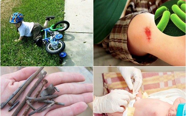 Uốn ván: Nguyên nhân, biểu hiện, cách điều trị và phòng bệnh