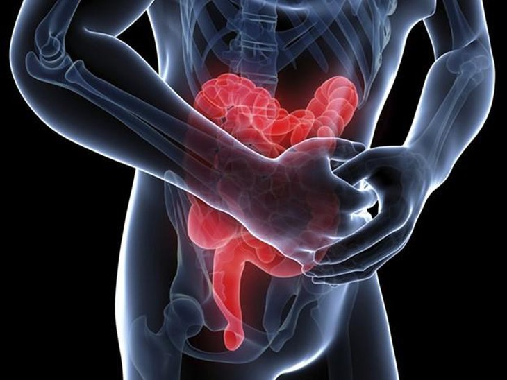 Thuốc và biện pháp điều trị viêm ruột do virus- Ảnh 1.