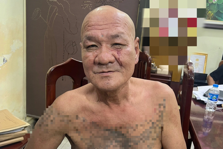 Khởi tố đối tượng chém gục người đàn ông trên phố Trần Quang Khải, Hà Nội- Ảnh 1. Khởi tố đối tượng chém gục người đàn ông trên phố Trần Quang Khải, Hà Nội- Ảnh 1.