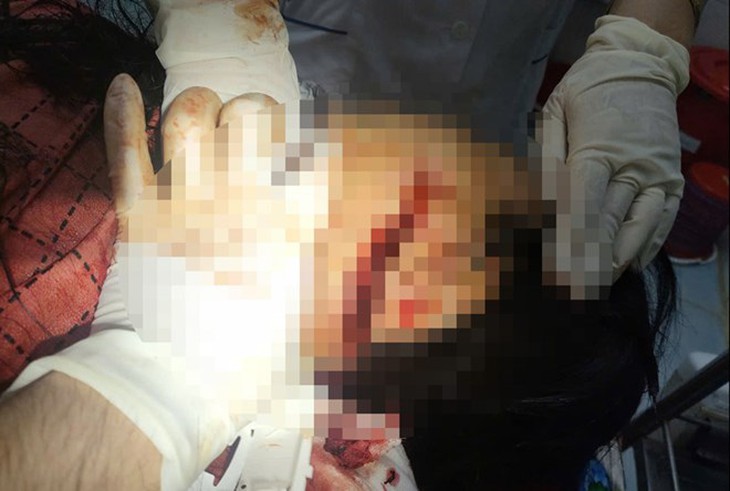 Chồng đánh vợ trọng thương rồi bỏ trốn- Ảnh 1. lào cai
