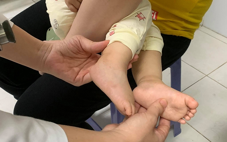 Nên chữa bệnh tay chân miệng ở nhà hay đến cơ sở y tế?- Ảnh 1.