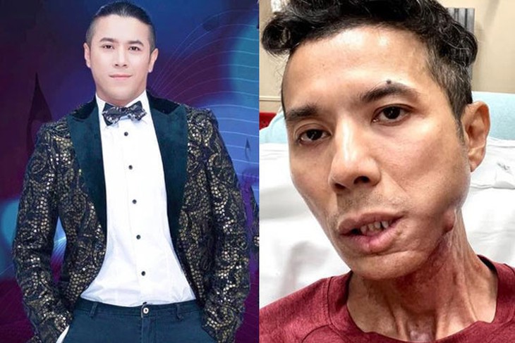 Kasim Hoàng Vũ lên tiếng về tình hình sức khỏe, hiện sống ra sao tại Mỹ?- Ảnh 1. Kasim Hoàng Vũ lên tiếng về tình hình sức khỏe, hiện sống ra sao tại Mỹ?- Ảnh 1.