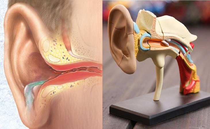Viêm tai giữa mạn tính ở trẻ em: Nguyên nhân, triệu chứng, phòng bệnh và cách điều trị- Ảnh 3. Viêm tai giữa mạn tính ở trẻ em: Nguyên nhân, triệu chứng, phòng bệnh và cách điều trị- Ảnh 3.