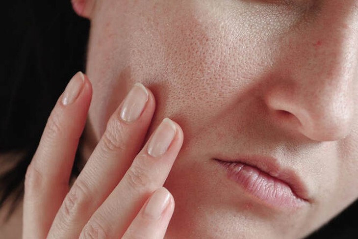 Da dầu có lão hóa chậm hơn da khô?- Ảnh 1.