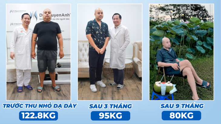 Phẫu thuật nội soi thu nhỏ dạ dày: Giải pháp giảm cân nhanh và an toàn cho người béo phì trầm trọng- Ảnh 2. Phẫu thuật nội soi thu nhỏ dạ dày: Giải pháp giảm cân nhanh và an toàn cho người béo phì trầm trọng- Ảnh 2.
