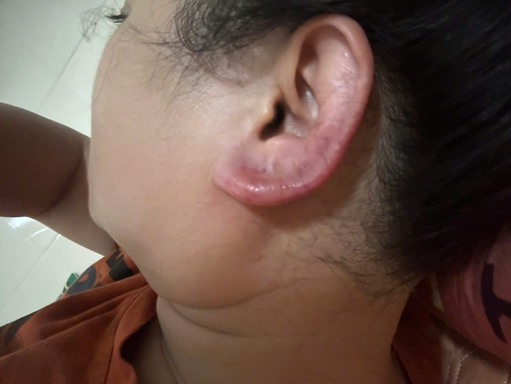 Vụ người phụ nữ nhập viện khi làm đẹp tại cơ sở thẩm mỹ: Công an vào cuộc làm rõ- Ảnh 2. Vụ người phụ nữ nhập viện khi làm đẹp tại cơ sở thẩm mỹ: Công an vào cuộc làm rõ- Ảnh 2.