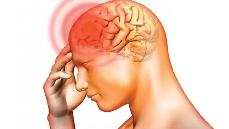 Viêm màng não mủ: Nguyên nhân, triệu chứng, cách điều trị và phòng bệnh- Ảnh 1. Viêm màng não mủ: Nguyên nhân, triệu chứng, cách điều trị và phòng bệnh- Ảnh 1.