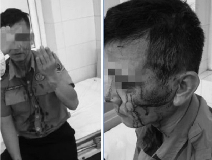 Bảo vệ Bệnh viện K bị ‘cò bệnh viện’ hành hung, phải khâu nhiều mũi- Ảnh 1.