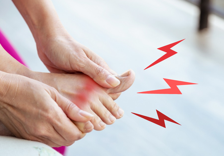 Thời tiết nắng nóng cẩn thận với cơn gout cấp- Ảnh 1.