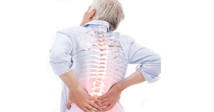 Vôi hóa cột sống là tình trạng lắng đọng canxi ở các cột sống, thường là do cột sống bị suy giảm chức năng tự nhiên.