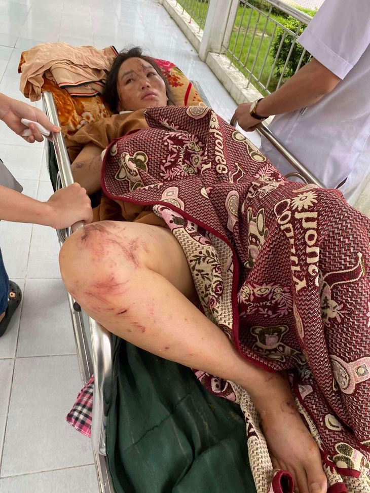Khiêng người bị thương đi bộ 7km để cấp cứu trong vụ sạt lở ở Bắc Hà- Ảnh 6. Khiêng người bị thương đi bộ 7km để cấp cứu trong vụ sạt lở ở Bắc Hà- Ảnh 6.