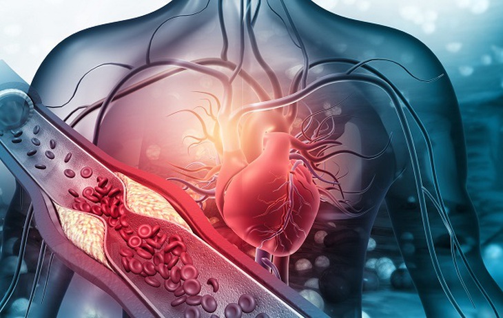 Bí quyết ăn uống giúp giảm cholesterol hiệu quả nhất- Ảnh 1. Bí quyết ăn uống giúp giảm cholesterol hiệu quả nhất- Ảnh 1.