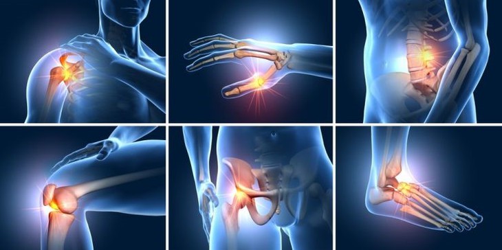 Dược phẩm Liên Doanh Đức cho ra thị trường sản phẩm hỗ trợ giảm triệu chứng đau vai gáy xương khớp mới- Ảnh 3. Dược phẩm Liên Doanh Đức cho ra thị trường sản phẩm hỗ trợ giảm triệu chứng đau vai gáy xương khớp mới- Ảnh 3.
