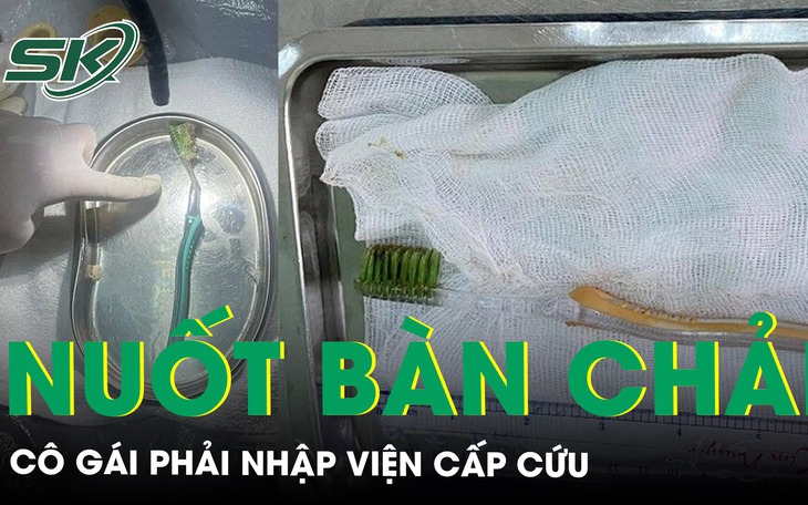Hi hữu cô gái 19 nuốt bàn chải đánh răng dài 15cm