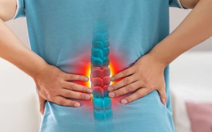 Đau lưng âm ỉ là dấu hiệu cảnh báo những bệnh gì?- Ảnh 1.