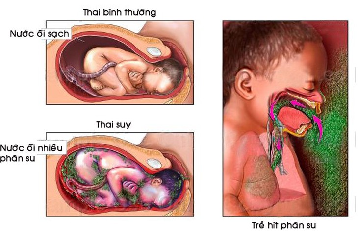 Câu hỏi thường gặp liên quan đến bệnh suy thai- Ảnh 1.