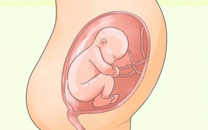 Câu hỏi thường gặp liên quan đến bệnh rỉ ối