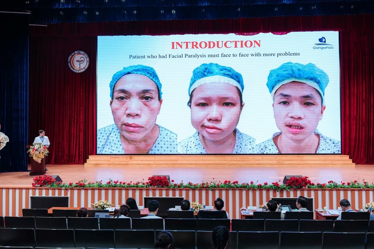 Ấn tượng bài báo cáo về điều trị liệt mặt của BS Phùng Mạnh Cường tại Hội nghị CSAPS MSAPS- Ảnh 4. Ấn tượng bài báo cáo về điều trị liệt mặt của BS Phùng Mạnh Cường tại Hội nghị CSAPS MSAPS- Ảnh 4.
