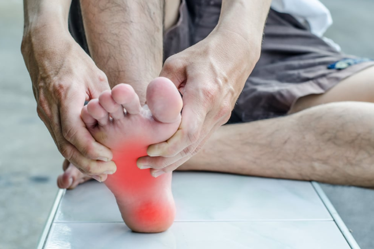 Viêm cân gan chân: Nguyên nhân, triệu chứng, phòng bệnh và cách điều trị- Ảnh 2. Viêm cân gan chân: Nguyên nhân, triệu chứng, phòng bệnh và cách điều trị- Ảnh 2.