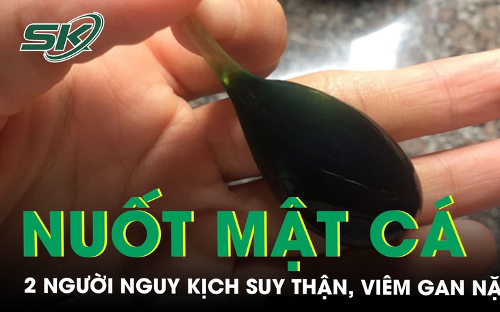 2 người nguy kịch, suy thận, viêm gan nặng do uống mật cá trắm 