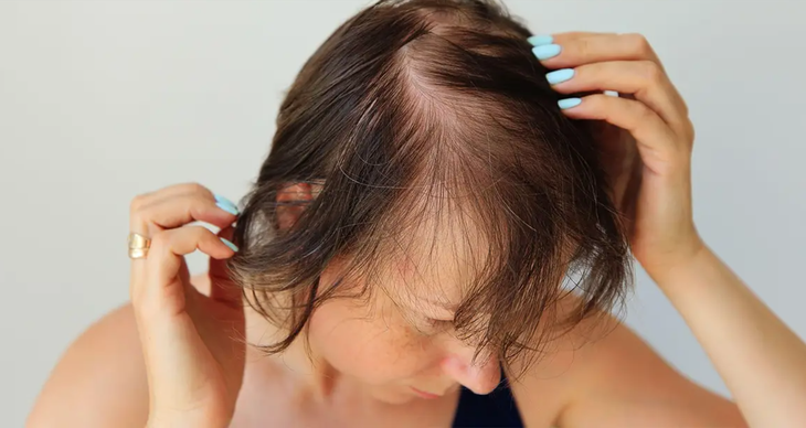 Gừng có kích thích mọc tóc không?- Ảnh 1.