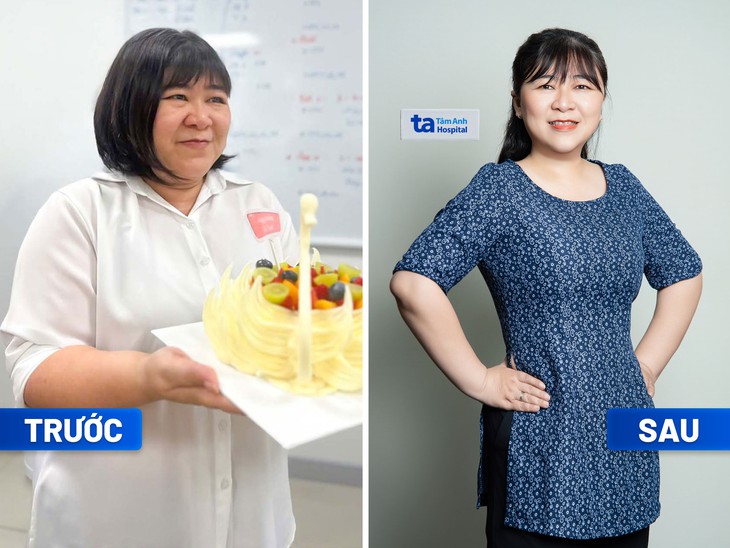 Nhiều phụ nữ có thân hình mơ ước nhờ giảm cân chuẩn y khoa- Ảnh 4. Nhiều phụ nữ có thân hình mơ ước nhờ giảm cân chuẩn y khoa- Ảnh 4.