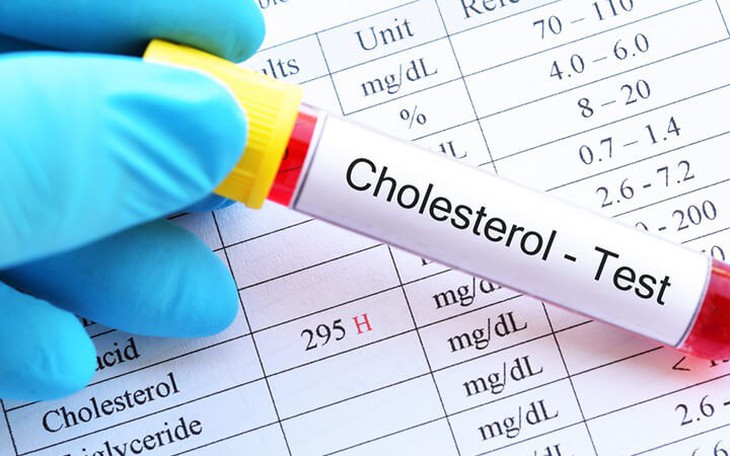 4 cách kiểm soát cholesterol máu để phòng ngừa bệnh tim mạch