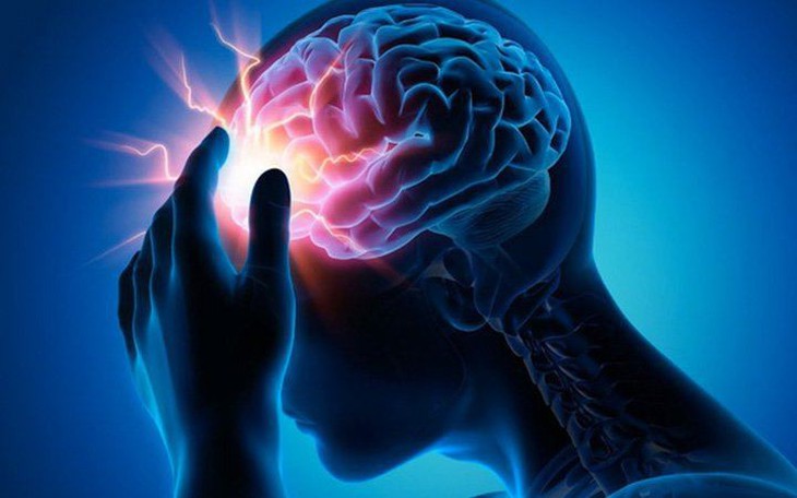 Bé gái bị đau đầu, động kinh, đi khám bác sĩ phát hiện mắc dị dạng mạch máu não