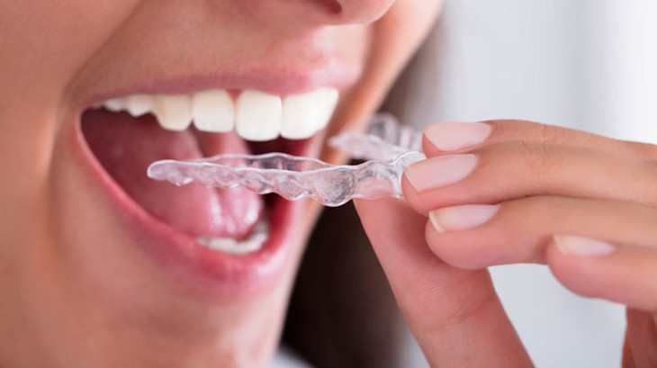 Có thuốc và phương pháp nào điều trị nghiến răng khi ngủ?- Ảnh 3.