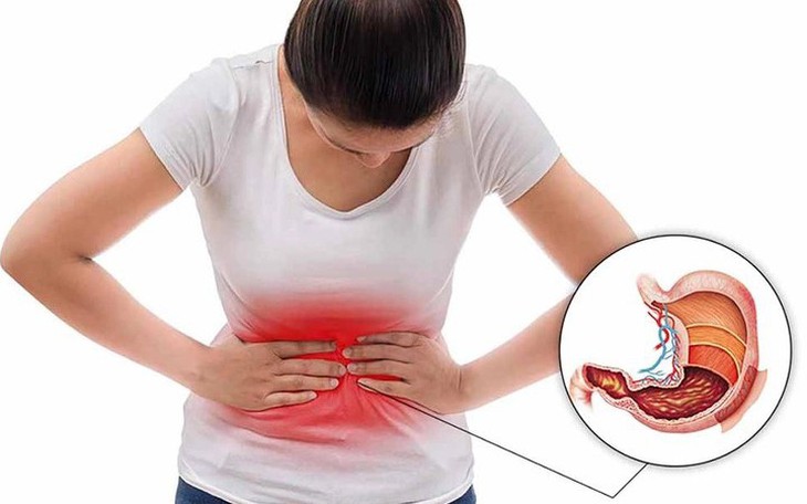 5 bí quyết phòng ngừa bệnh loét dạ dày tá tràng