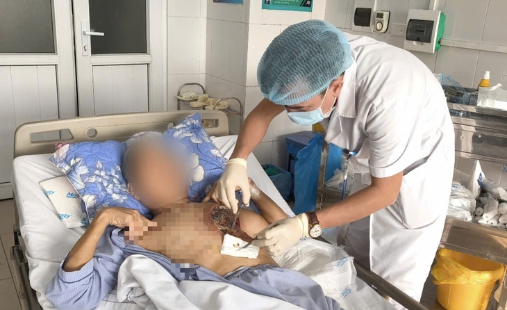 Loại nấm hiếm gặp 'ăn mòn' vùng ngực người quản trang- Ảnh 1. Loại nấm hiếm gặp 'ăn mòn' vùng ngực người quản trang- Ảnh 1.