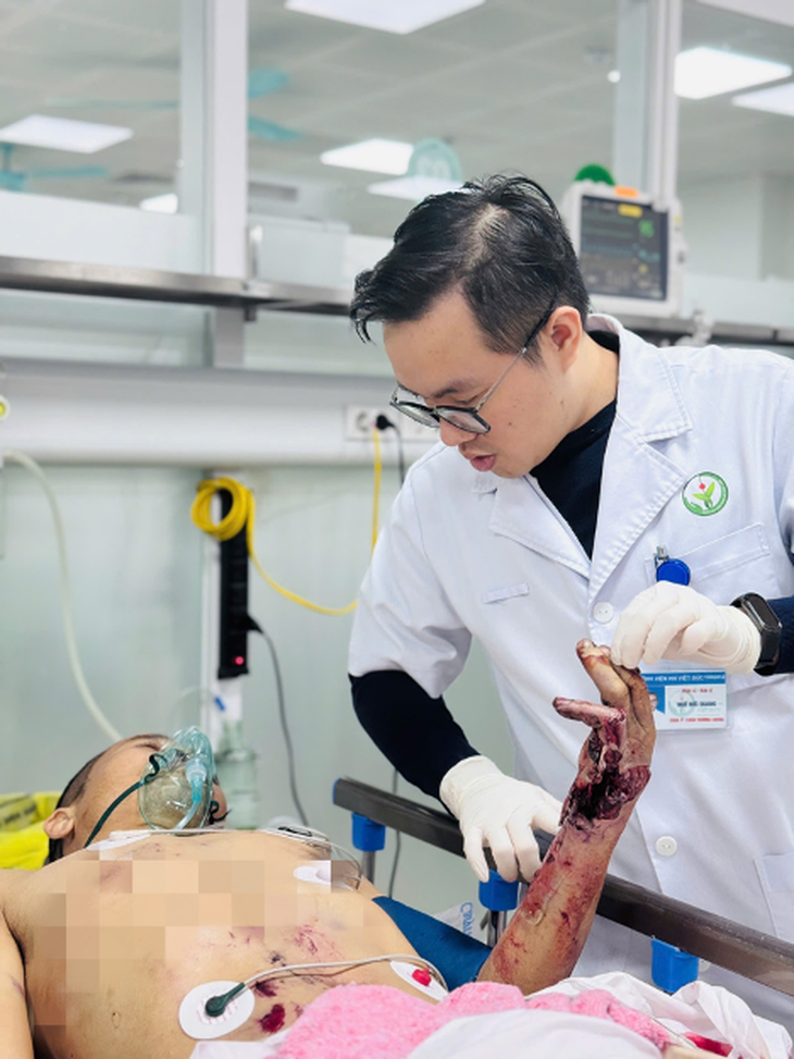 Người đàn ông nhập viện cấp cứu vì bình ga mini phát nổ khi nấu ăn- Ảnh 1. Người đàn ông nhập viện cấp cứu vì bình ga mini phát nổ khi nấu ăn- Ảnh 1.