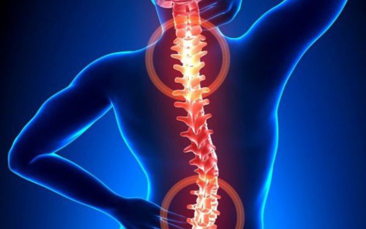 Người trẻ có mắc thoái hóa cột sống không?