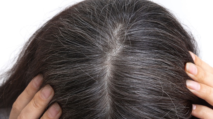 Bổ sung vitamin và khoáng chất giúp ngăn ngừa tóc bạc sớm- Ảnh 2.
