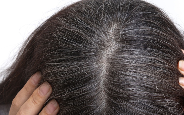 Bổ sung vitamin và khoáng chất giúp ngăn ngừa tóc bạc sớm