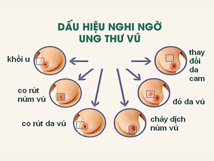 Dấu hiệu nhận biết căn bệnh Diva Hồng Nhung mắc phải, khuyến cáo chị em không được chủ quan- Ảnh 2. Dấu hiệu nhận biết căn bệnh Diva Hồng Nhung mắc phải, khuyến cáo chị em không được chủ quan- Ảnh 2.