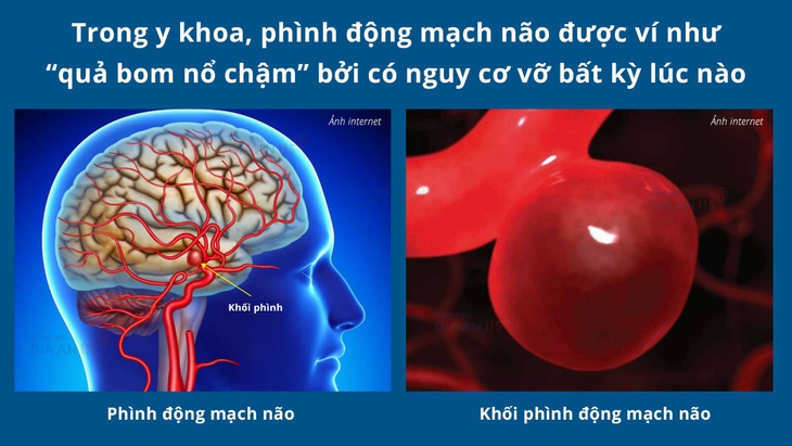 Đột quỵ não gặp nhiều ở người trẻ, chuyên gia cảnh báo những vấn đề cần chú ý khi thời tiết lạnh- Ảnh 1. Đột quỵ não gặp nhiều ở người trẻ, chuyên gia cảnh báo những vấn đề cần chú ý khi thời tiết lạnh- Ảnh 1.