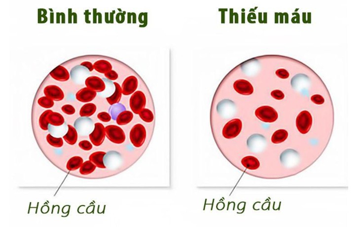 Tay chân lạnh cảnh báo điều gì?- Ảnh 1. Tay chân lạnh cảnh báo điều gì?- Ảnh 1.
