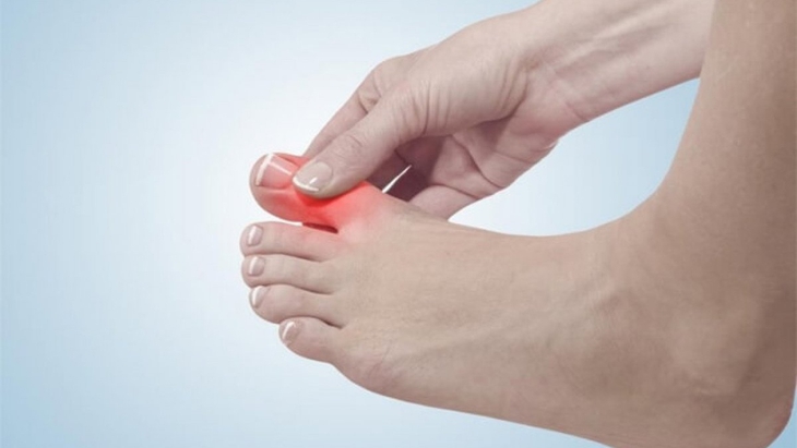 Cước sẽ trở nên nghiêm trọng hơn nếu bạn tiếp xúc với điều kiện thời tiết bất thường, thay đổi nhiệt độ đột ngột từ nóng sang lạnh hoặc từ lạnh sang nóng.