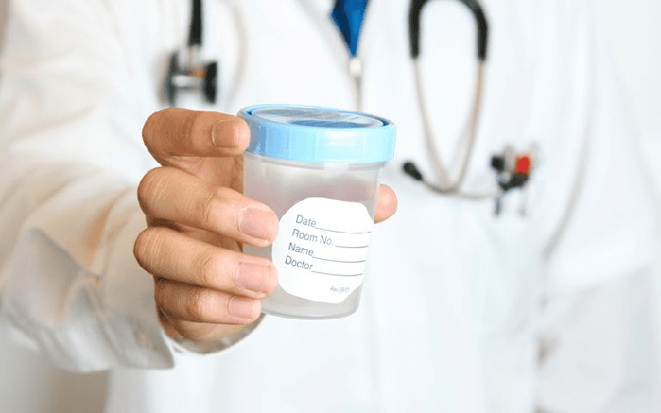 Hormone và tinh trùng nam suy giảm vì bệnh mãn tính- Ảnh 3.