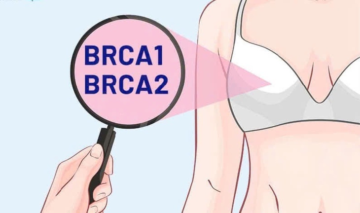 Cắt bỏ vú, buồng trứng của phụ nữ có gene ung thư vú có thể kéo dài cuộc sống- Ảnh 1. Cắt bỏ vú, buồng trứng của phụ nữ có gene ung thư vú có thể kéo dài cuộc sống- Ảnh 1.