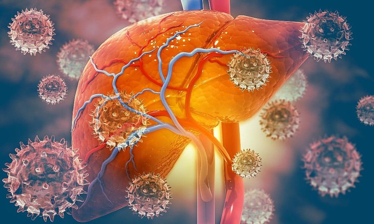 HIV làm tăng nguy cơ xơ gan và ung thư gan như thế nào?- Ảnh 1.