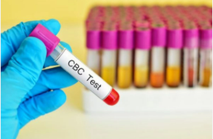 Những chỉ số máu quan trọng giúp quản lý HIV hiệu quả- Ảnh 1.