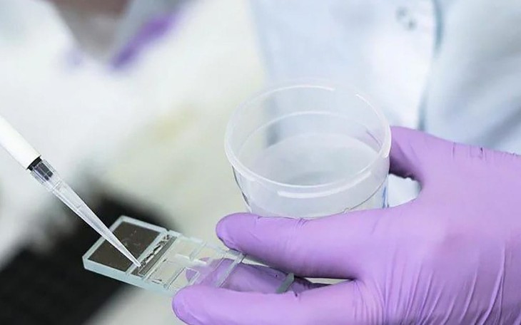 3 chiến lược bảo tồn khả năng sinh sản cho người nhiễm HIV