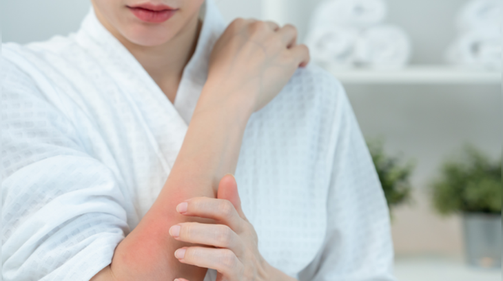 6 dấu hiệu trên da cảnh báo gan cần được chăm sóc ngay- Ảnh 1.