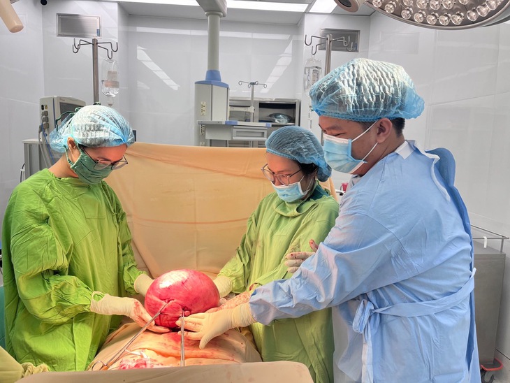 Cắt khối u xơ tử cung nặng 4,5kg, bụng nữ bệnh nhân to như thai 28 tuần- Ảnh 4.
